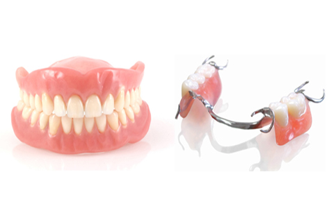 Phục hình tháo lấp răng giả - Những trường hợp mất răng có thể làm phục  hình tháo lấp